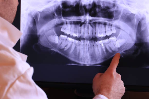 Best Broken or Cracked Tooth Emergency Dentist in Irmo, SC